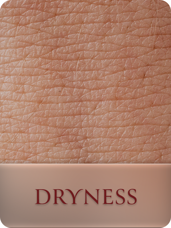 Dry Skin